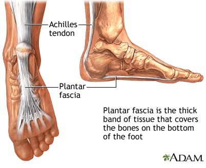 Plantar Fasciitis - Image from A.D.A.M. - - Image for Educational & Informative purposes only 